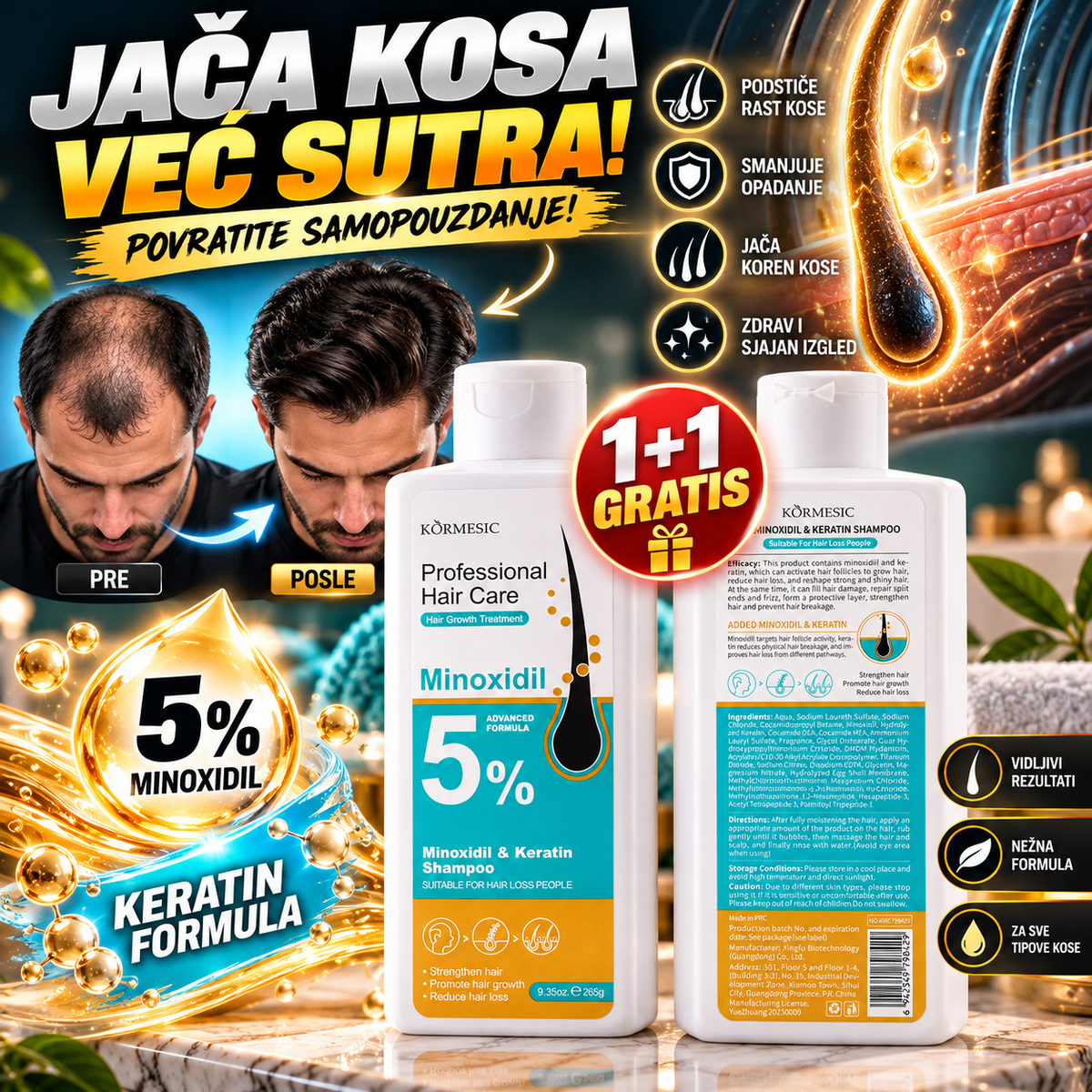 Profesionalni Šampon za Kosu sa Minoksidilom i Keratinom 5% – Formula za Negu Kose, 265g 1+1 GRATIS
